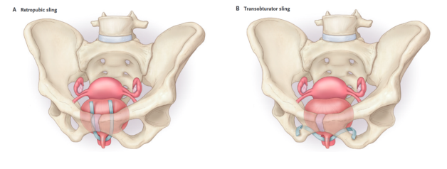 16837705653450.png 16837705653450.png