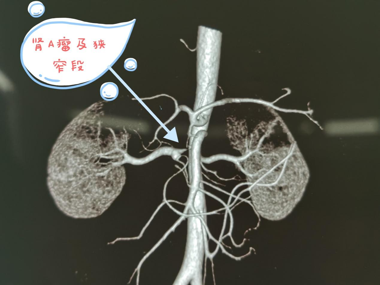 16953505995238.png 16953505995238.png