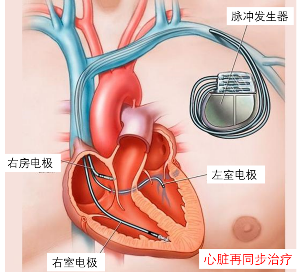 16988881712054.png 16988881712054.png