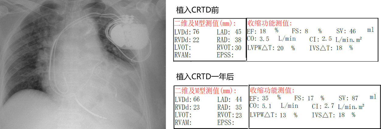 16988885452075.png 16988885452075.png