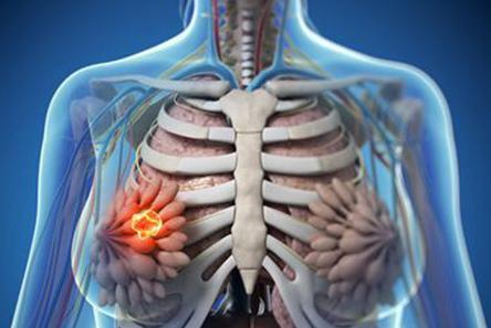 17030424082120.png 17030424082120.png