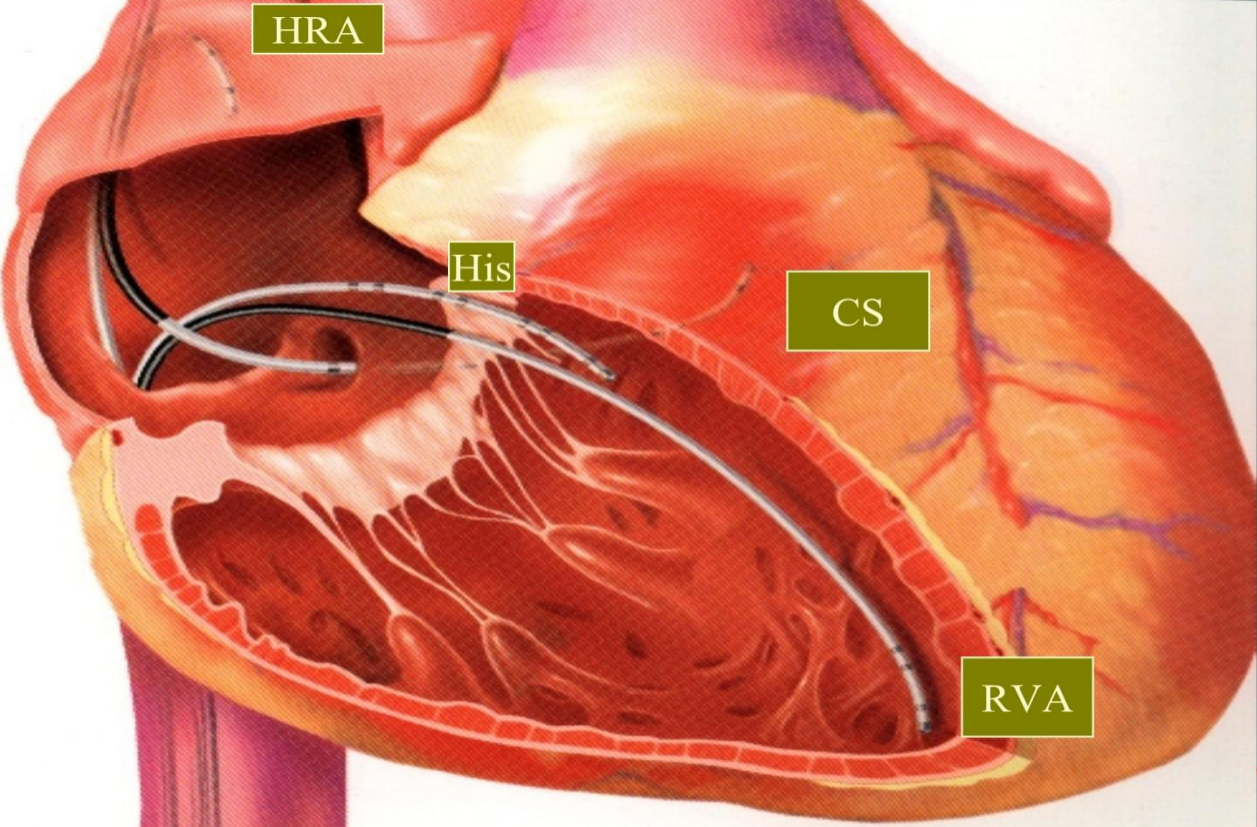 17109035377740.png 17109035377740.png