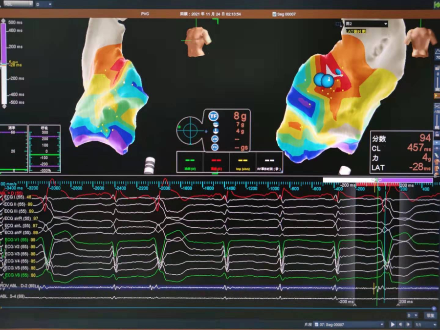 17109040236196.png 17109040236196.png