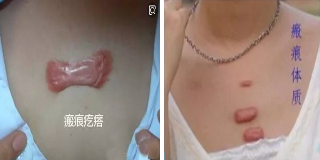 17115044243293.png 17115044243293.png