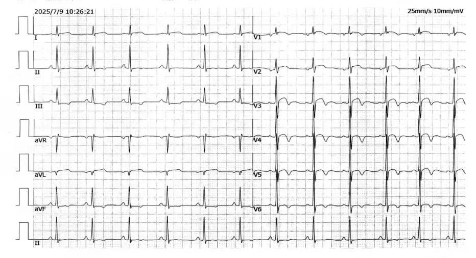 17540090336008.png 17540090336008.png